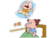 为什么会得水痘呢 出水痘应该注意什么 - 识趣