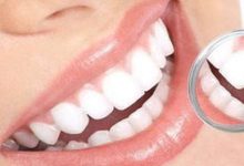 补牙医保可以报销吗 补牙医保能报销多少 - 识趣